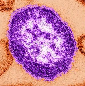 la-sci-sn--measles-virus-cancer-20140516